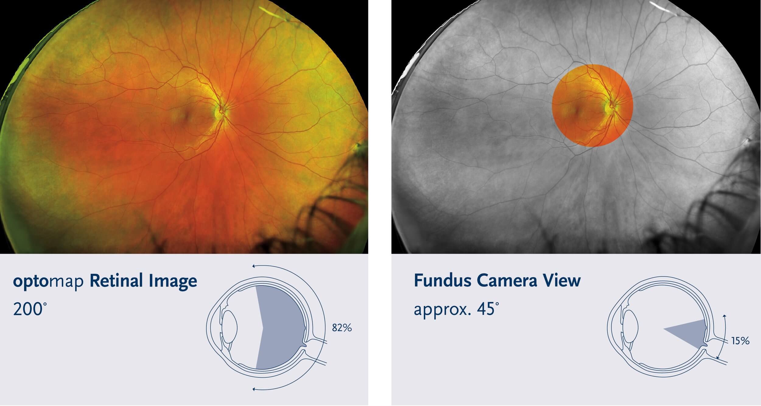 Comparison-Fields-of-View(1)(1)
